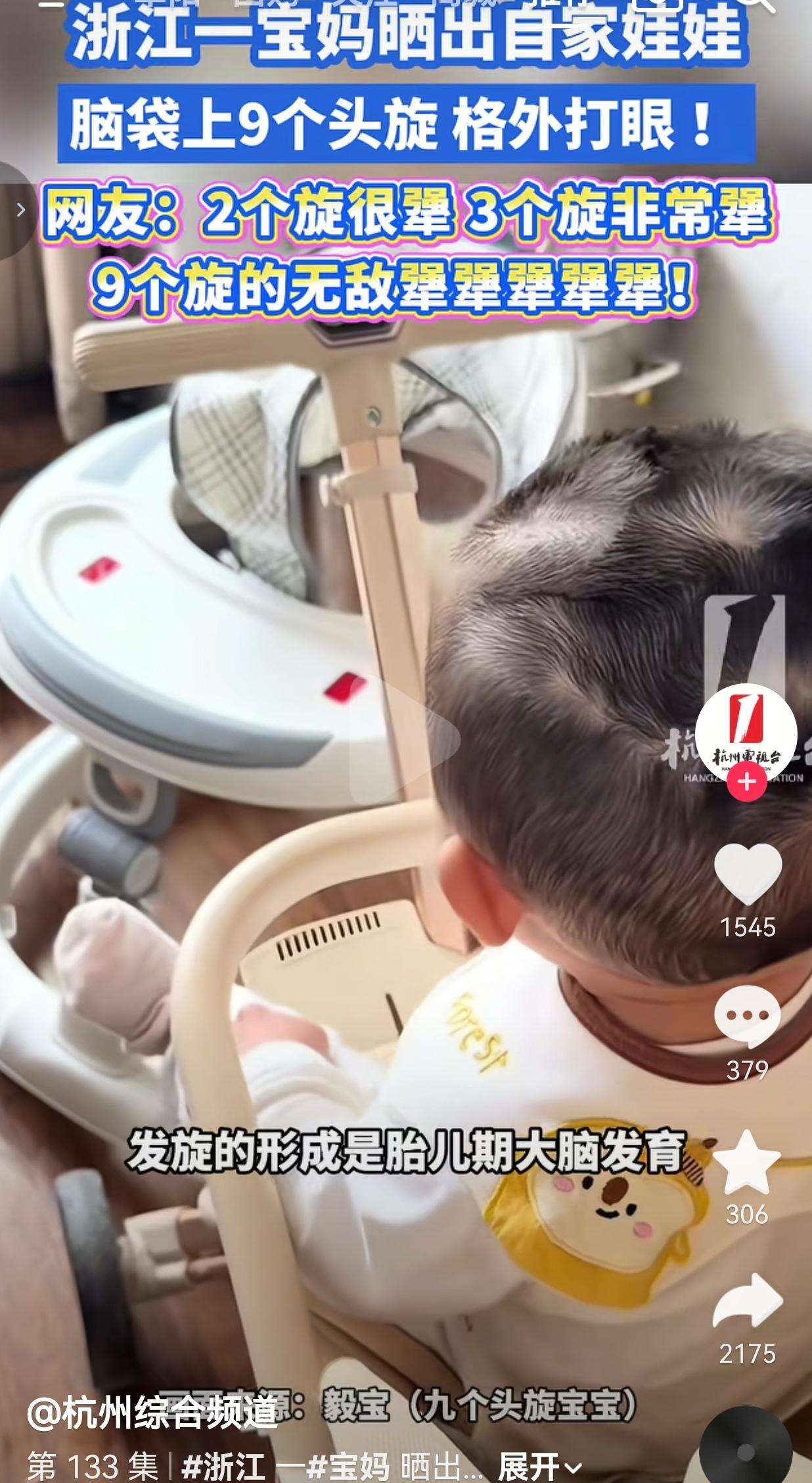 全网都在好奇！浙江萌娃脑袋上9个头旋，网友笑疯：这是“天生犟种”天花板？
 
浙