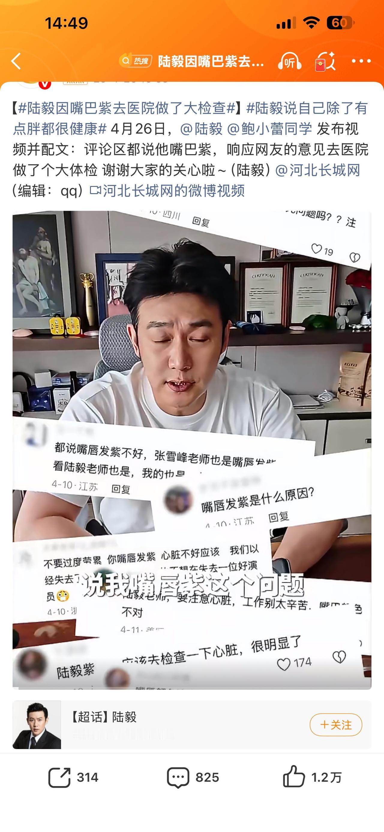 陆毅：你看我这嘴巴，是不是紫得有点过分了？网友都在催我去医院，要不咱还是去查查吧