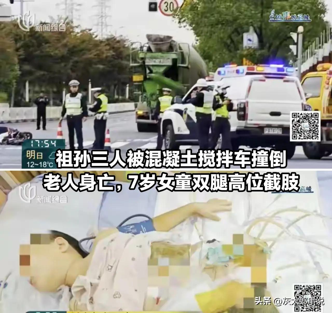 送医后经过医护人员20多天的全力抢救，虽高位截肢。重伤的大女儿总算保住了性命。