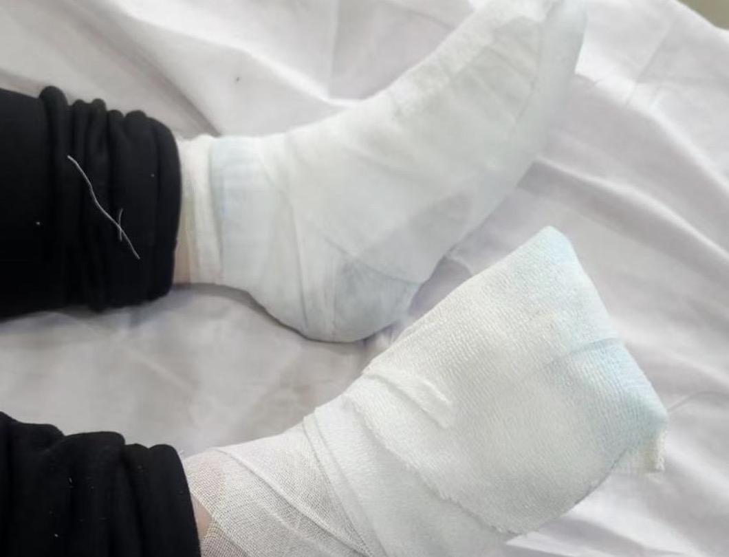 21岁的大三女生来东北游玩，滑倒摔晕在路边被严重冻伤，还有可能面临着截肢，谁又该