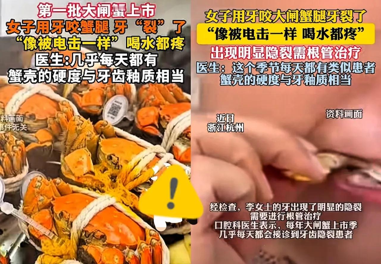 悲剧还是发生了！”
近日，浙江杭州，
一女子在家吃螃蟹，她用
牙齿咬开螃蟹腿时遭