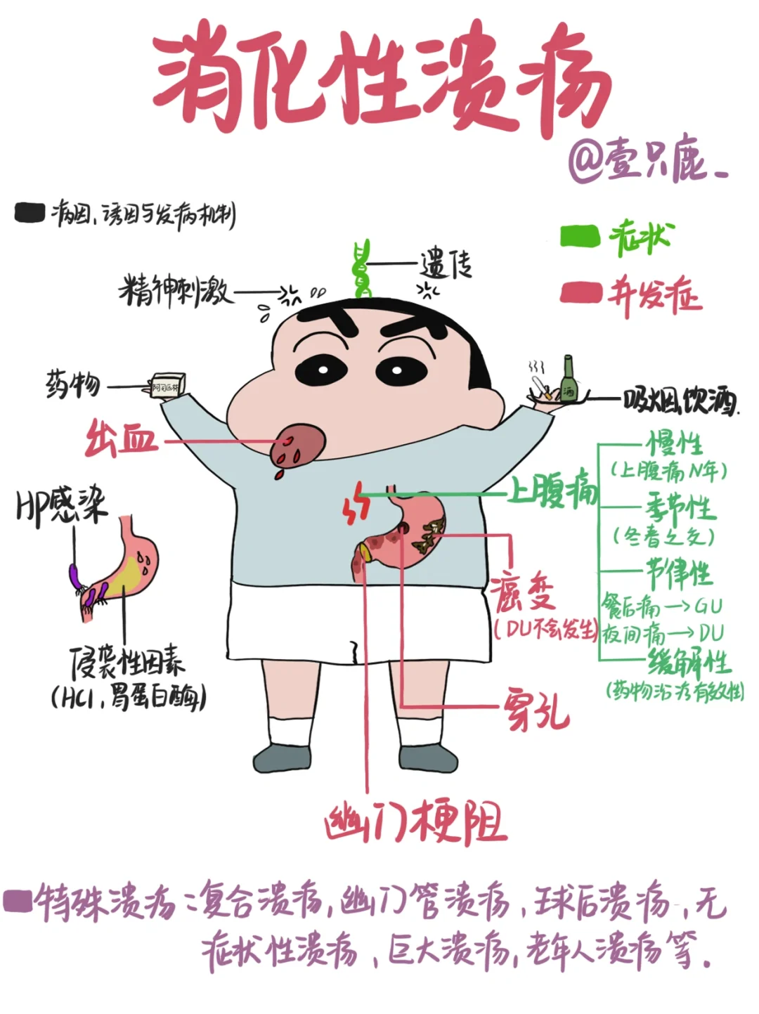 医学生笔记📒｜消化性溃疡🧐