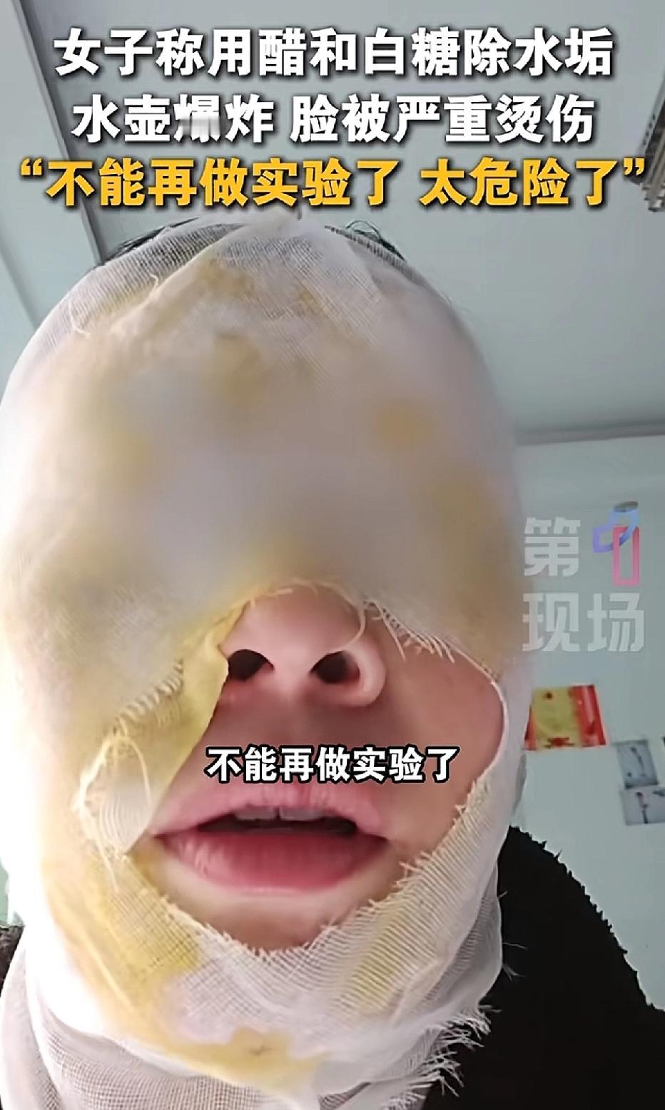 女子把白糖和醋混合烧开后，倒入保温瓶除垢。几分钟后，她打开保温瓶盖子查看效果，没