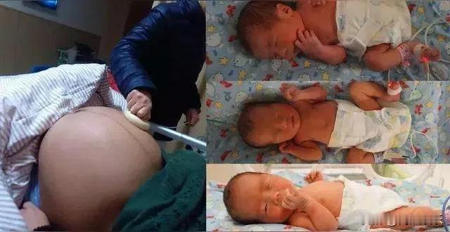 😲你们相信吗，杭州有个21岁的女子小周，因为肚子疼以为是痛经去了医院，结果到那