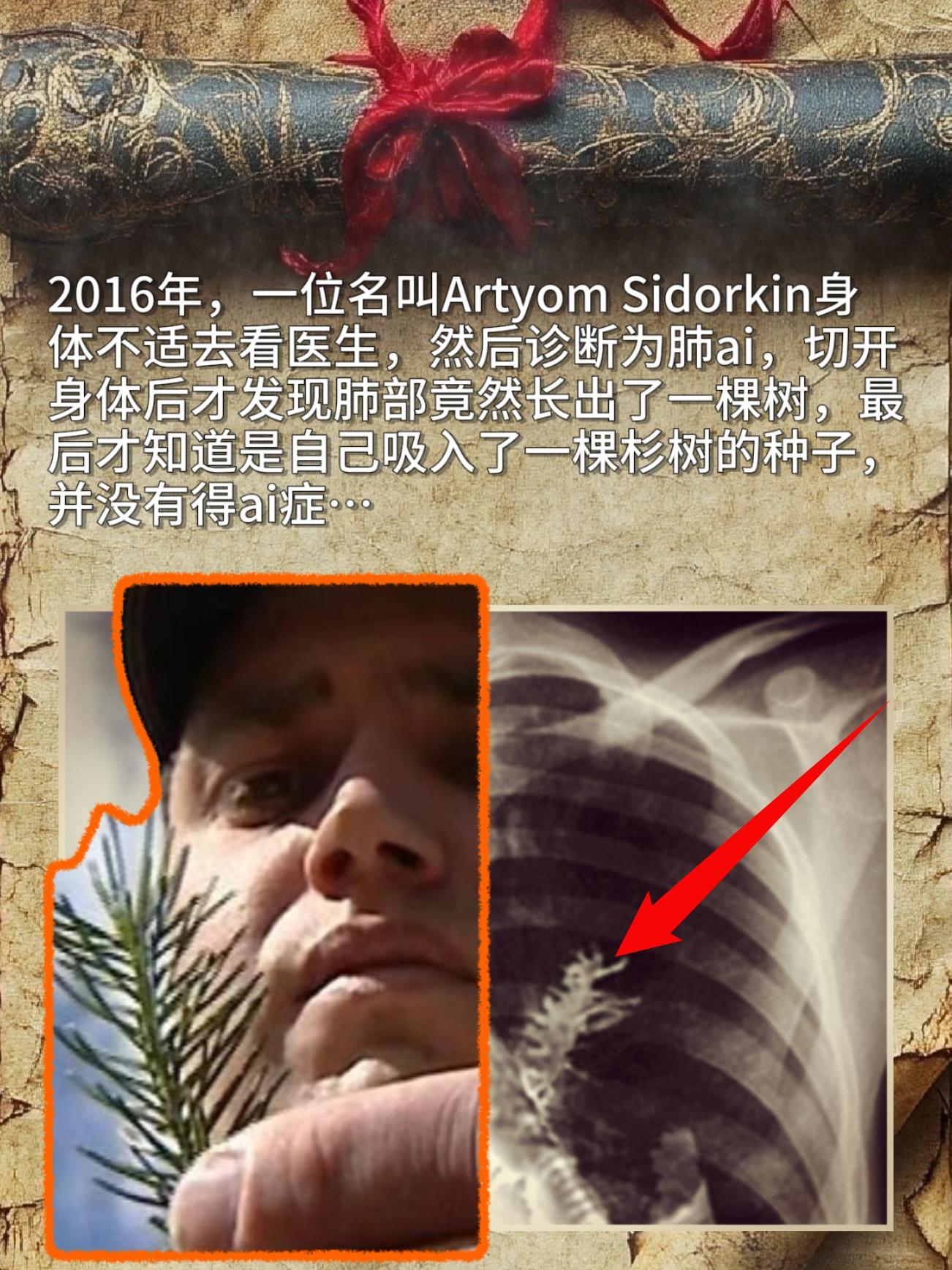戏剧的一刻！2016年，一位名叫Artyom Sidorkin身体不适...