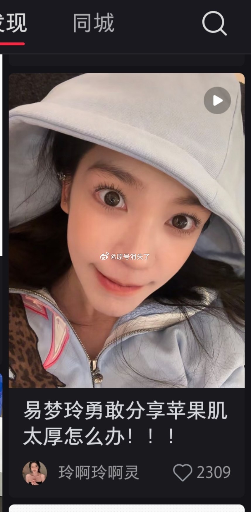 网页链接易梦玲亲自分享改善苹果肌肿胀的调理方法，核心是抗炎饮食 + 16+8 间
