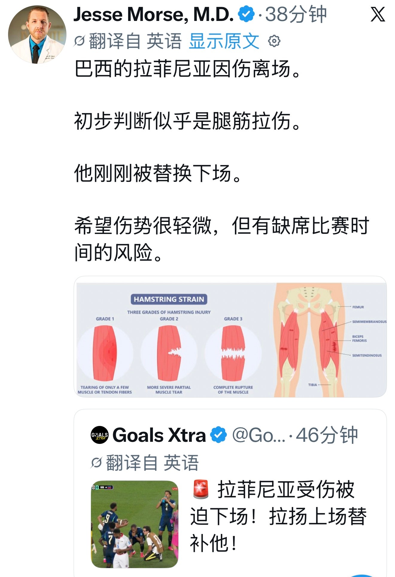 哎