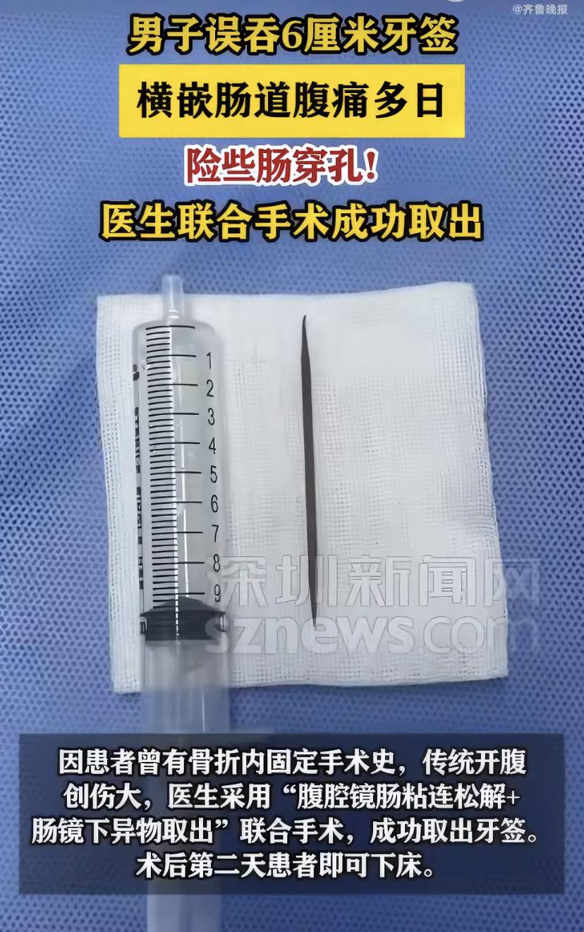 南京38岁男子肚子疼了14天，差点没命!一查竟是肠道藏了根6厘米牙签，已经戳穿肠