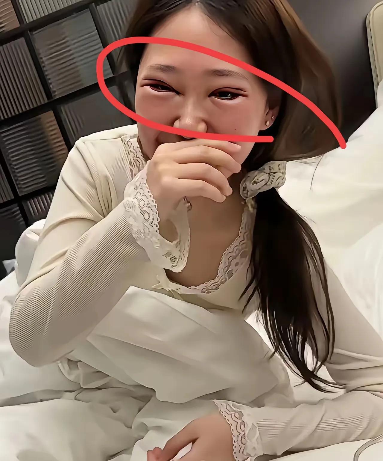 割双眼皮的是新手吧，双眼皮割这么宽，消肿了也难看。
女人爱美是天性，都喜欢折腾脸