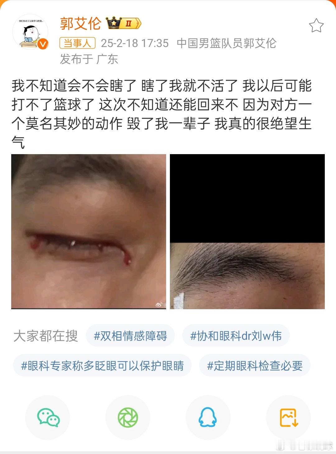 郭艾伦说真的很绝望生气  郭艾伦眼睛流血 看上去很严重[衰]但是相信医院，相信医