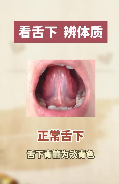 舌下藏着健康密码，一看就懂你的体质
