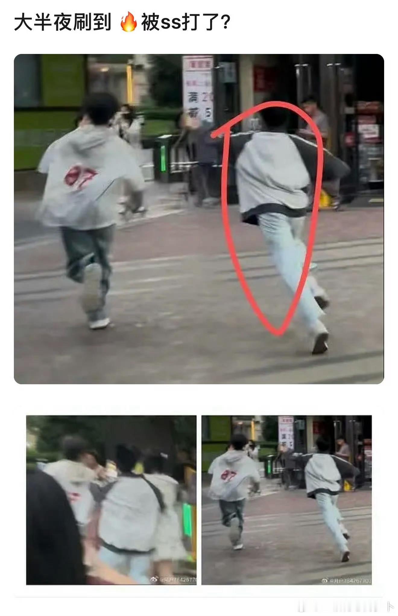 时代峰峻又出新事故……四代练习生张奕然被私生给打了，太离谱了吧曝张奕然被私生打了