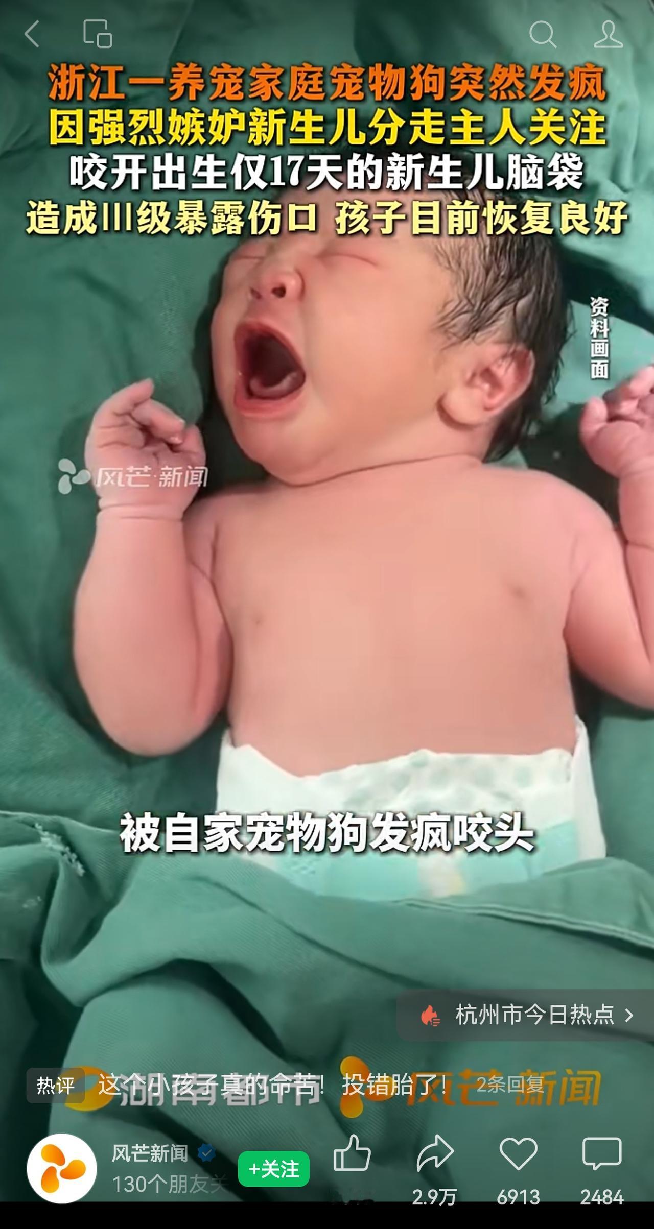 还说自家的狗狗从不咬人吗？