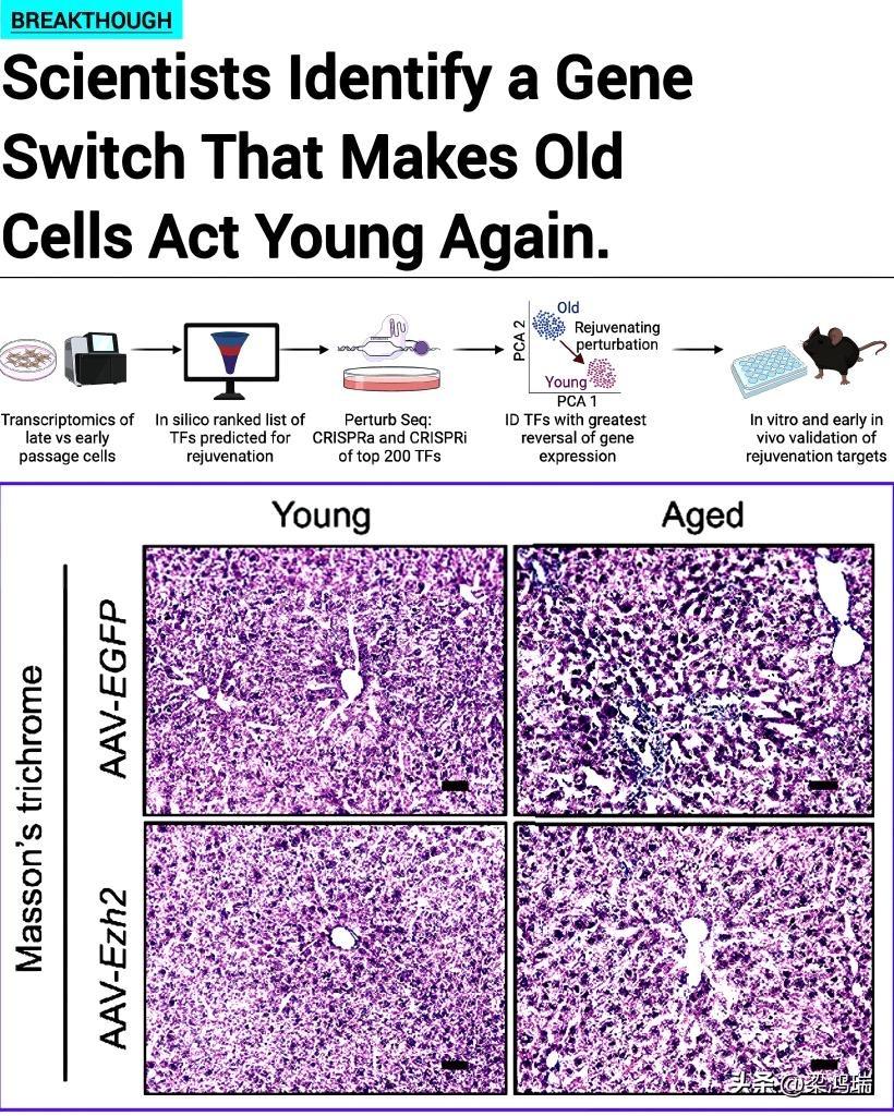 美国科学家们可能已经找到了一种让衰老细胞恢复活力的分子蓝图。加州大学旧金山分校的