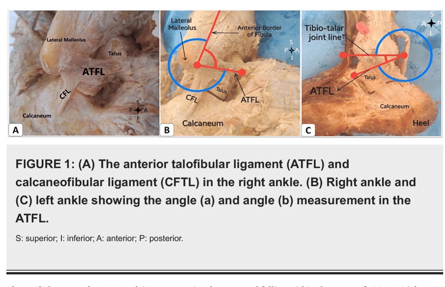 全面了解踝关节外侧韧带的解剖和相互关系。对临床检查至关重要！