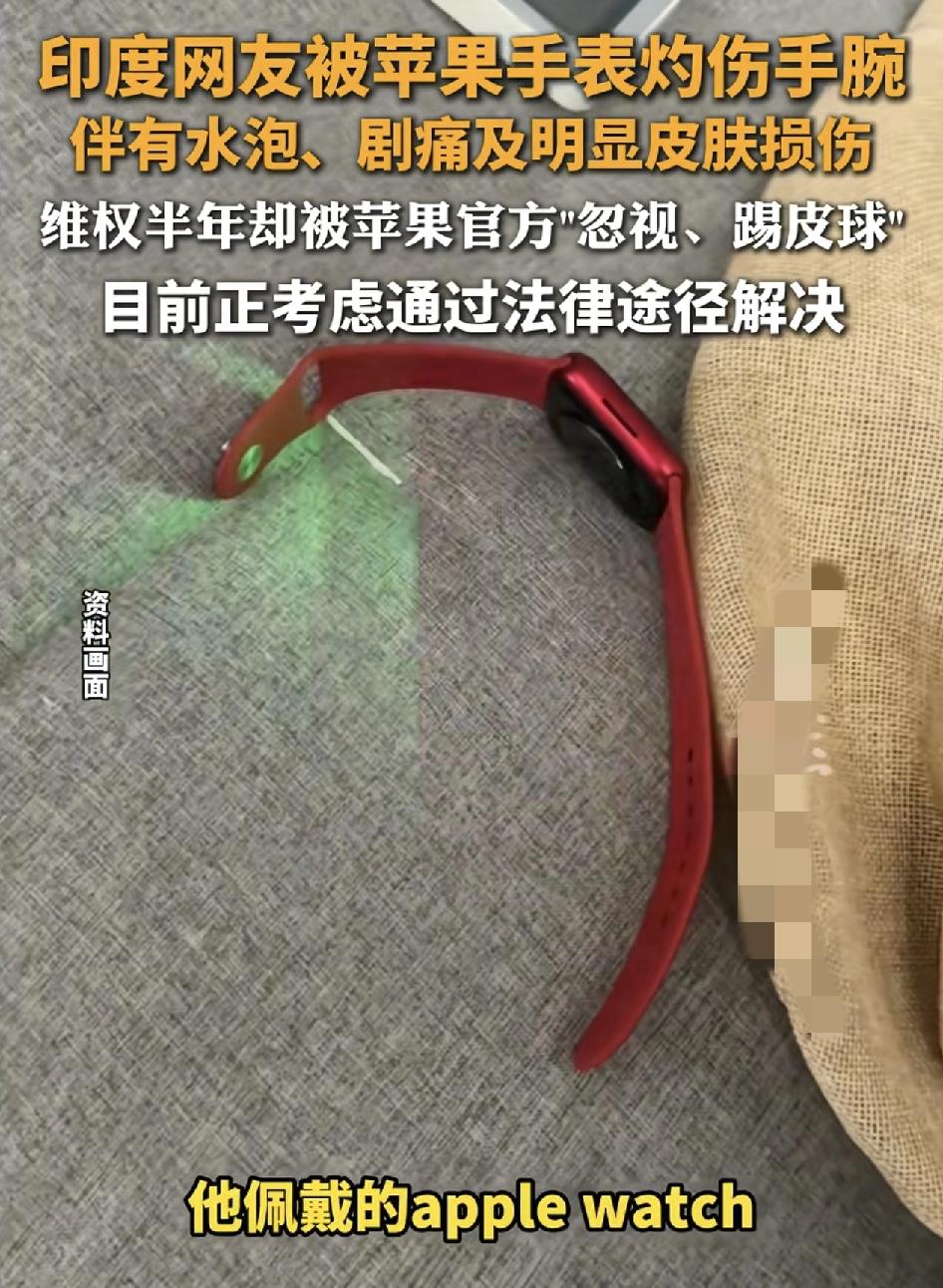 有消费者反映自己佩戴的苹果手表被严重灼伤，维权半年无果。这款苹果手表佩戴时突然高