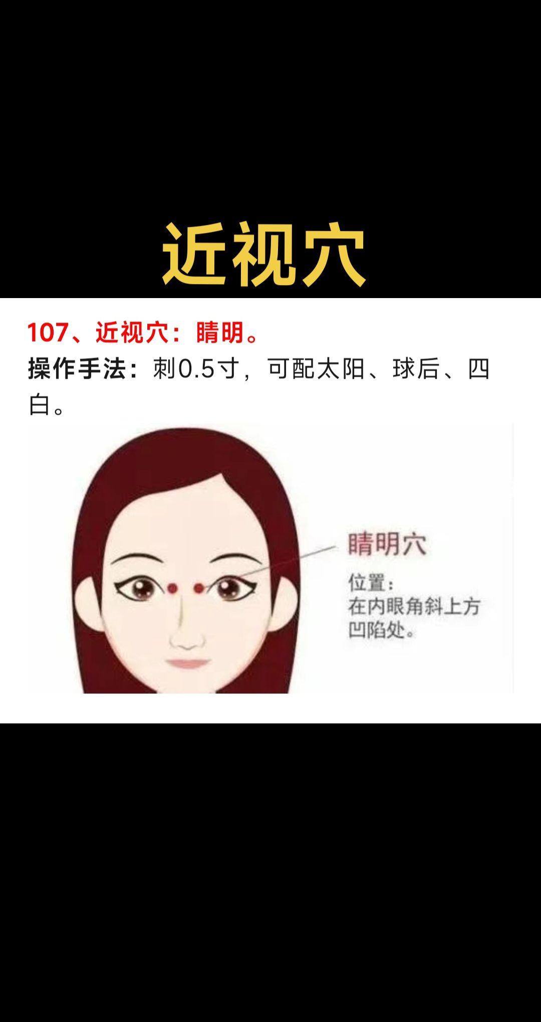 放松眼睛预防近视