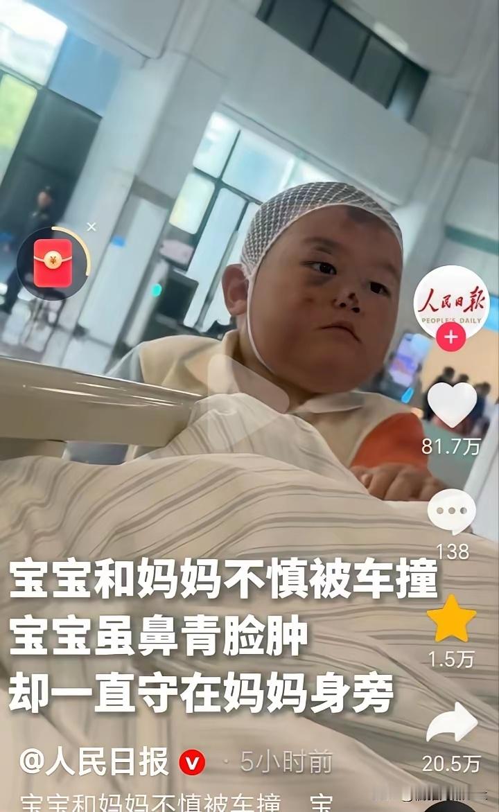 重情重义这事，真是天生的。刷到一条新闻，母子俩被车撞了，妈妈重伤多处骨折，宝宝也