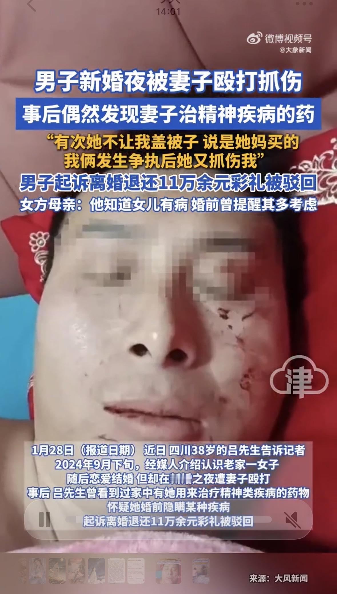 新婚夜，本应洞房花烛，却被妻子拳脚相加。38岁的吕先生，脸上脖子上全是抓伤。你说