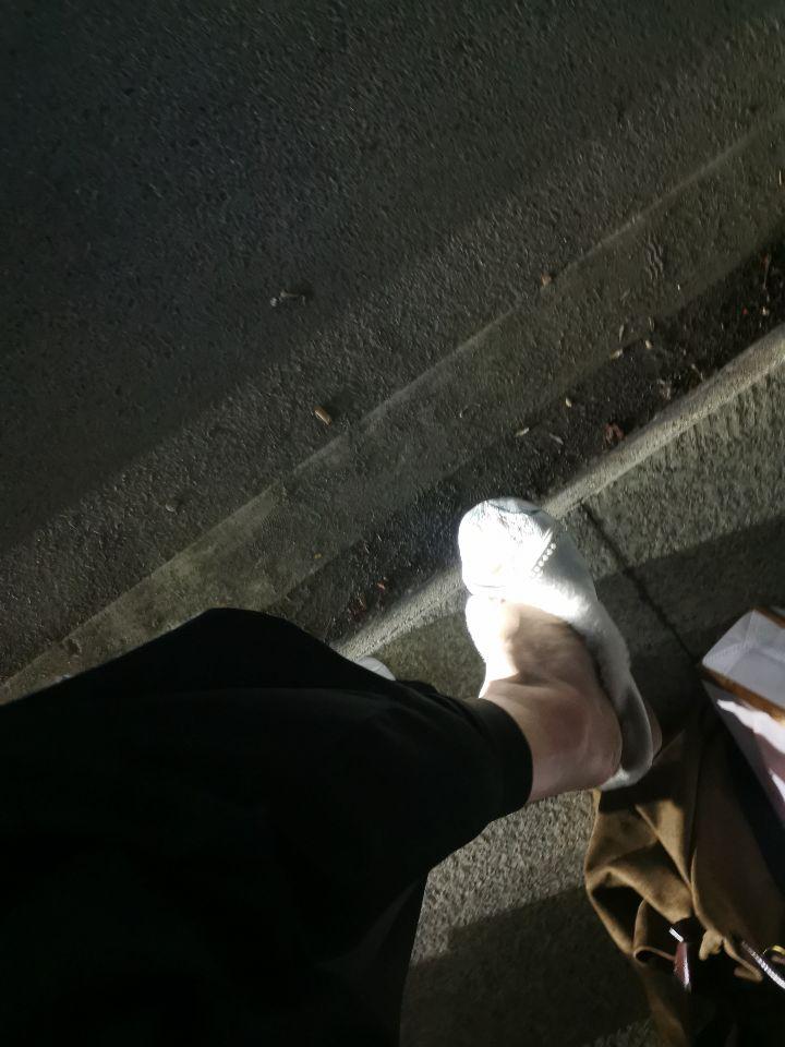到底怎么搞的 怎么凸起来的地方那么肿 好多天了