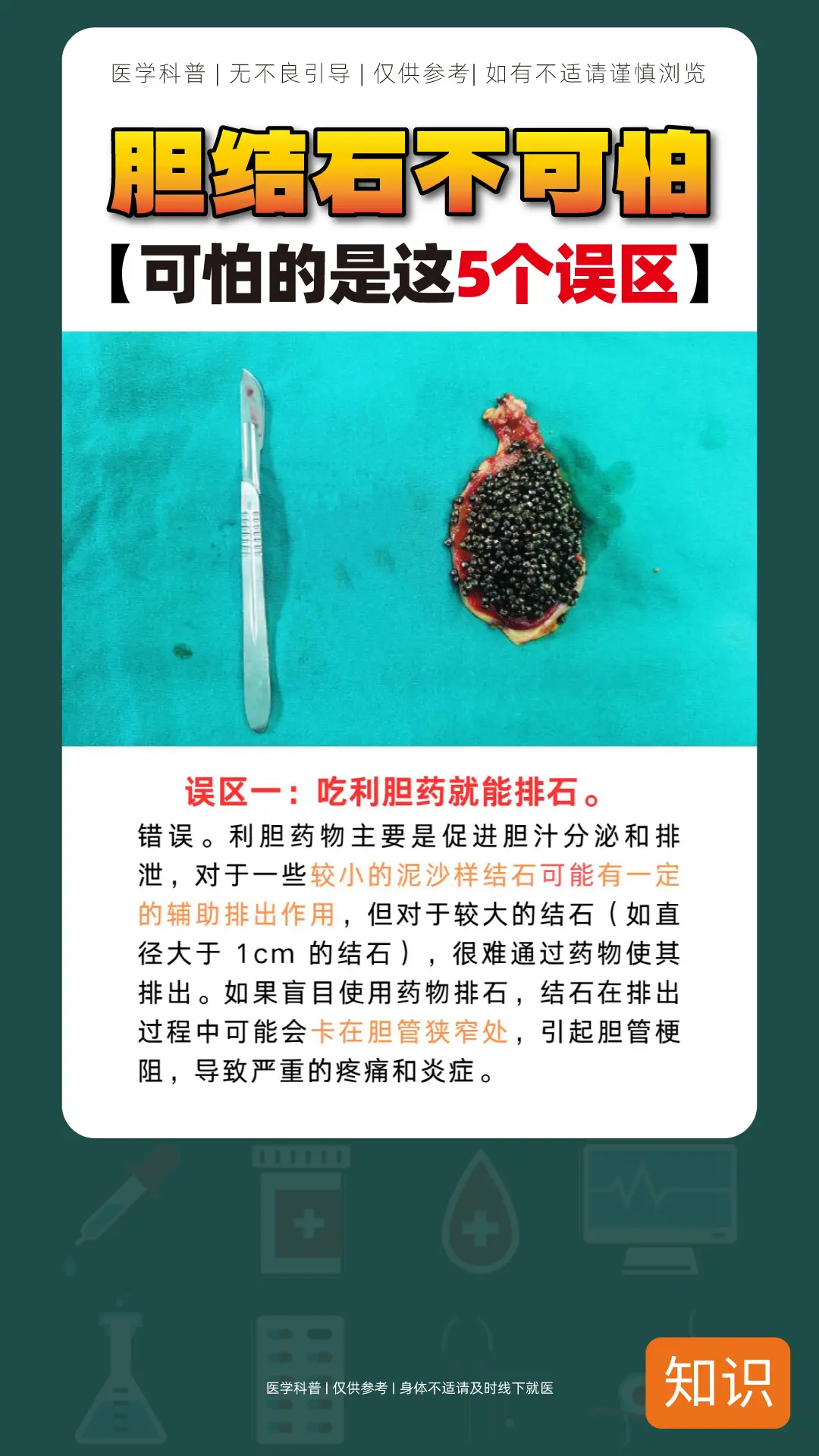 胆结石不可怕，可怕的是这五个误区。