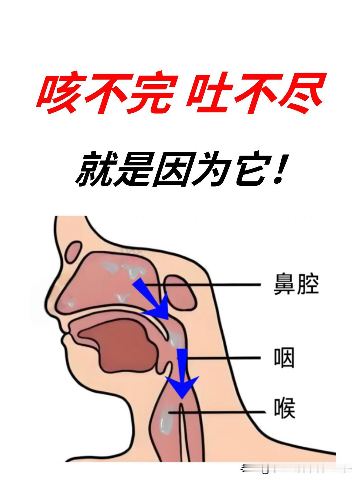 咳不完吐不尽，可能是因为它！
 
不久前呢，就有这样一个患者，来时跟我说了他的情