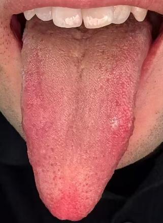 精血不足恢复慢，中医辨证调养有方







很多人年少不知道节制，如今长期纵