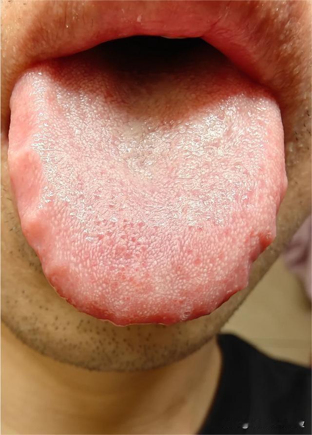 这个大兄弟，九点上床闭眼，到1点愣是没睡着，听得我又气又笑[泪奔][泪奔]
前天