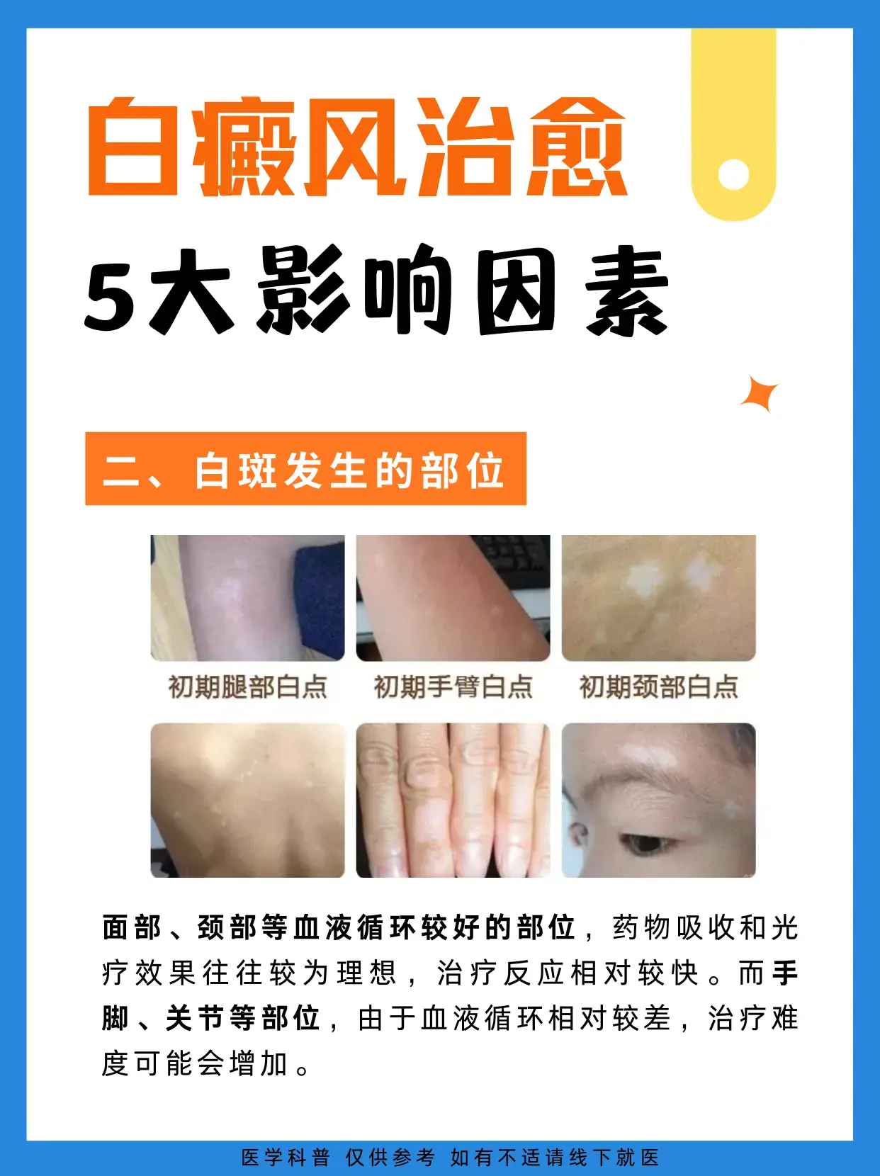 医学科普 白癜风 白斑 硬核健康科普行动  知识分享