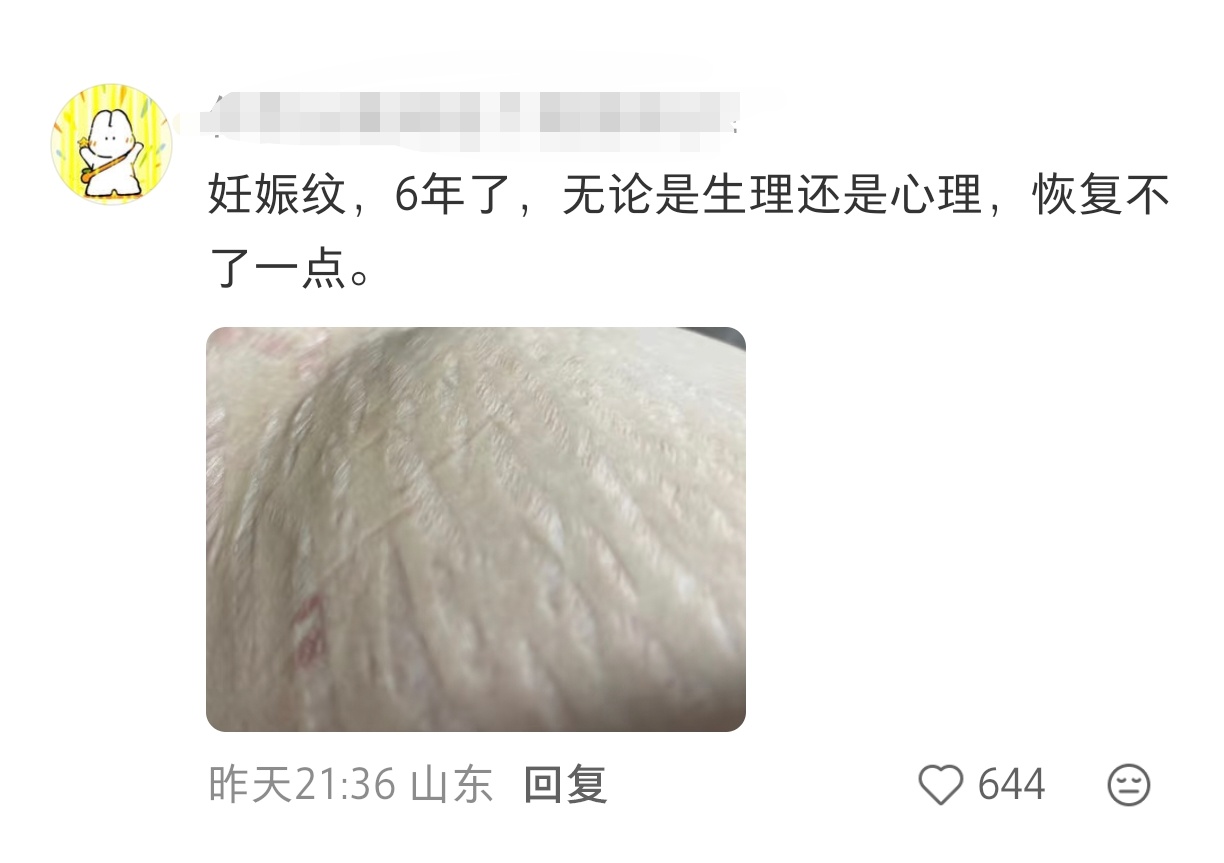 无意间找到了最像妊娠纹和生育后阴部撕裂的纹路之物 ​​​