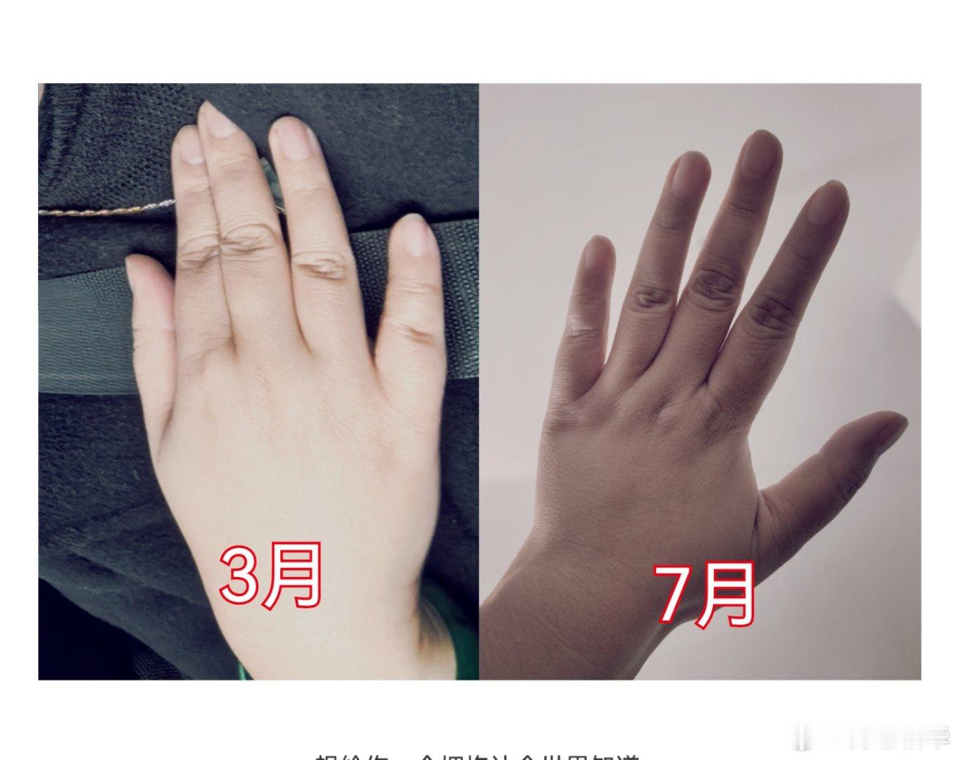 俺的爪，也恢复了正常……之前真是小猪蹄。 ​​​