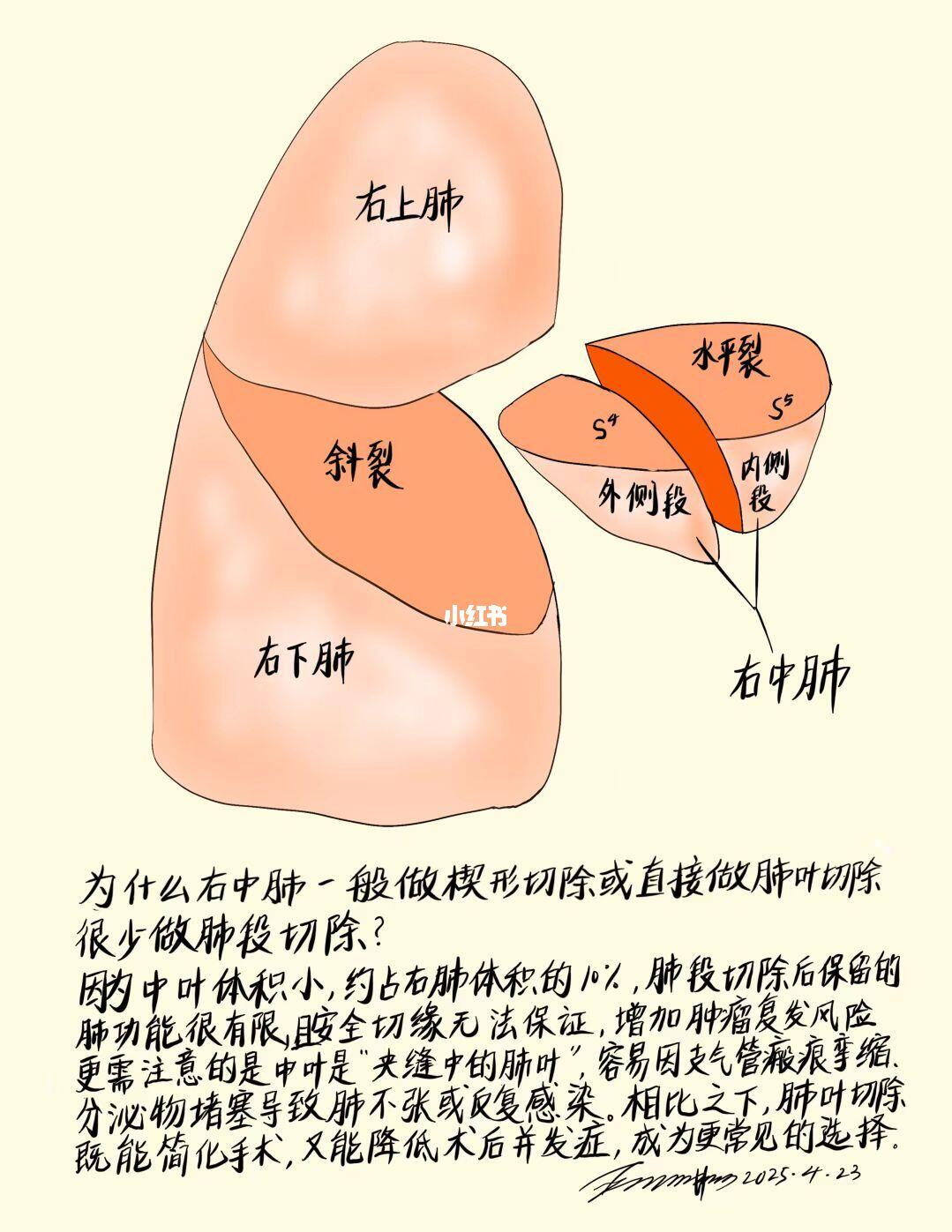 为什么右中肺很少做肺段切除？