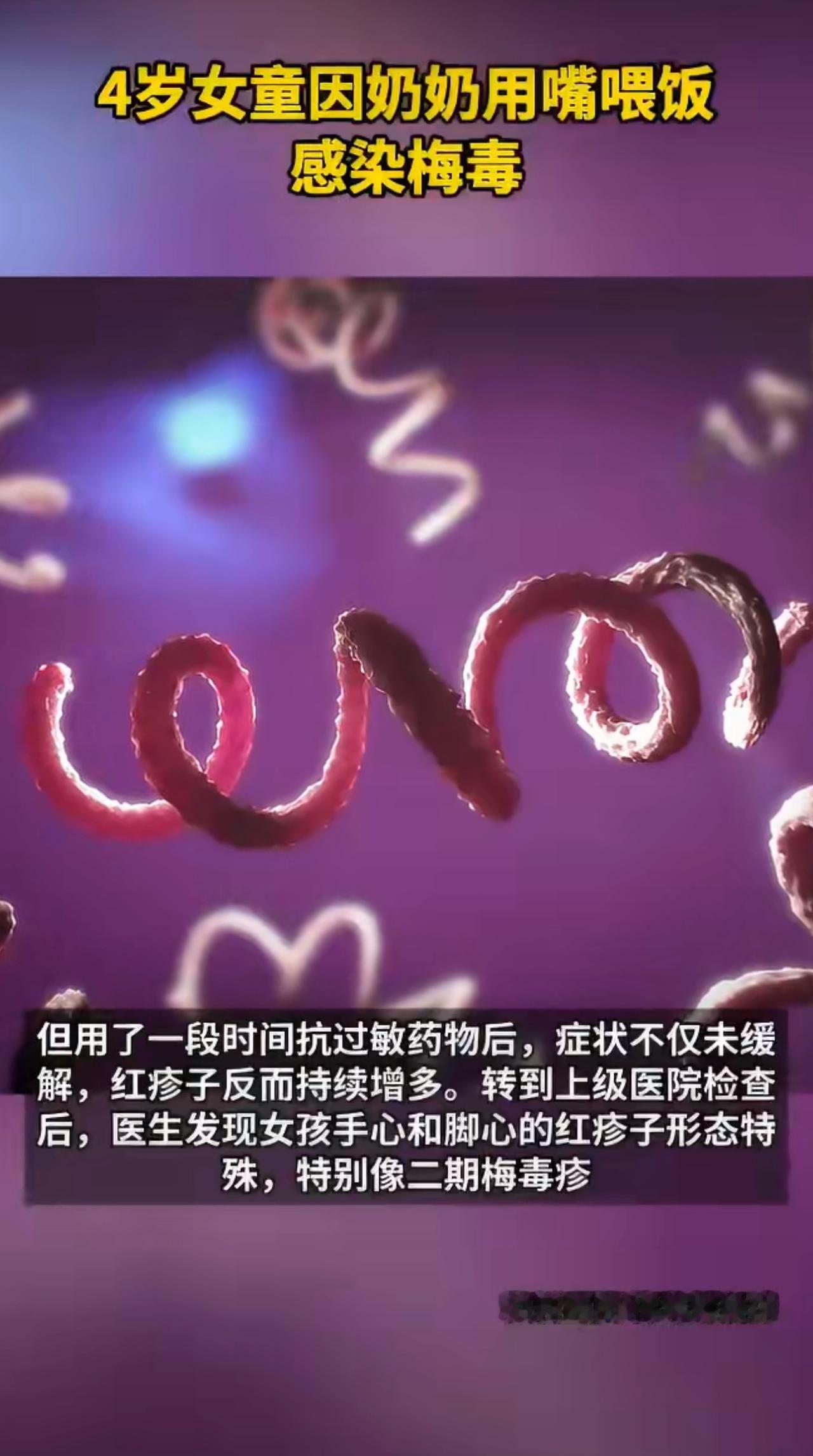 最近有件让人揪心的事在家长圈传开了——安徽有个4岁小女孩，突然全身冒出不痛不痒的