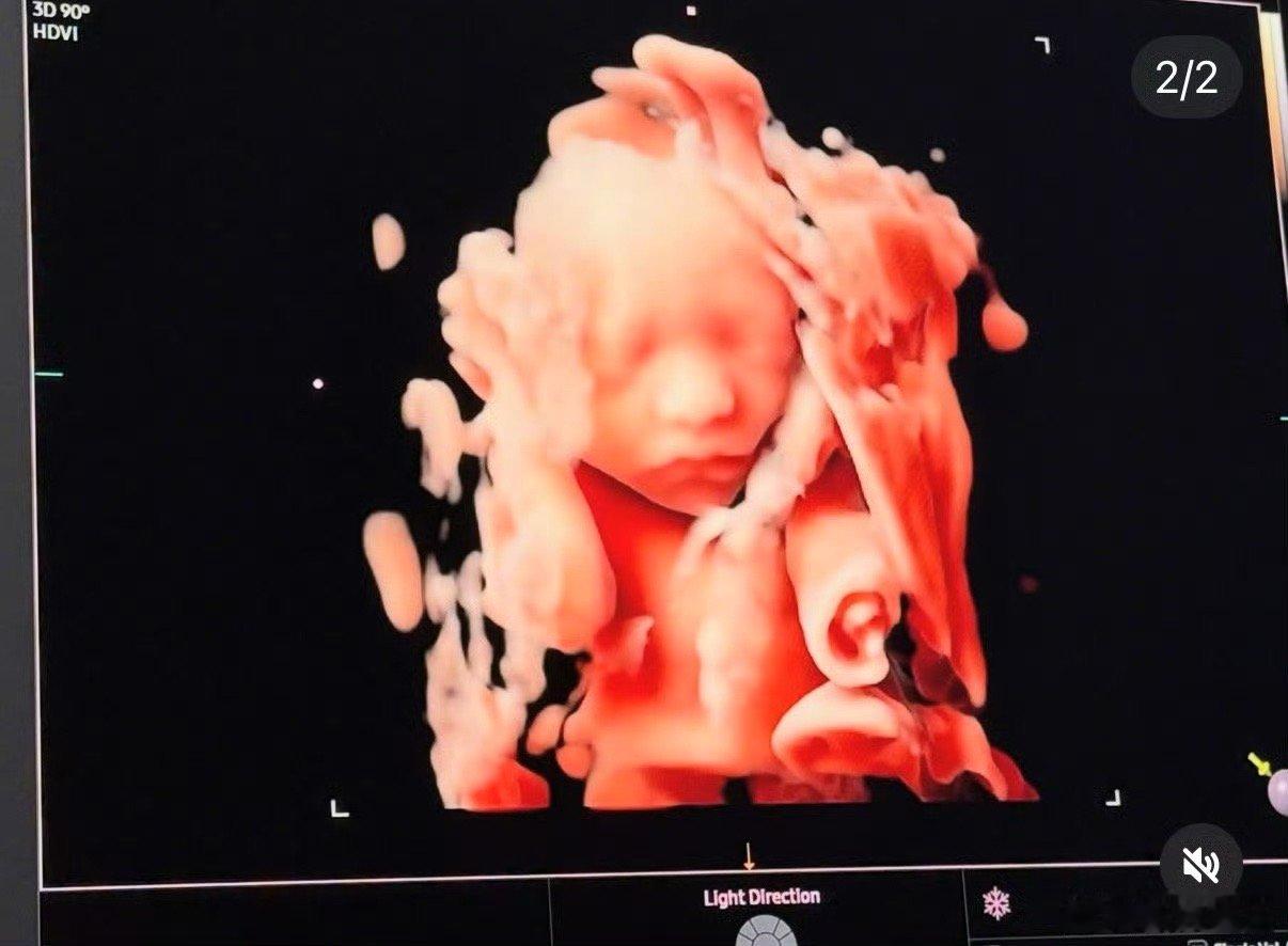 宋承炫宣布当爸宋承炫老婆怀孕 21日，前FTISLAND成员宋承炫晒宝宝B超照，