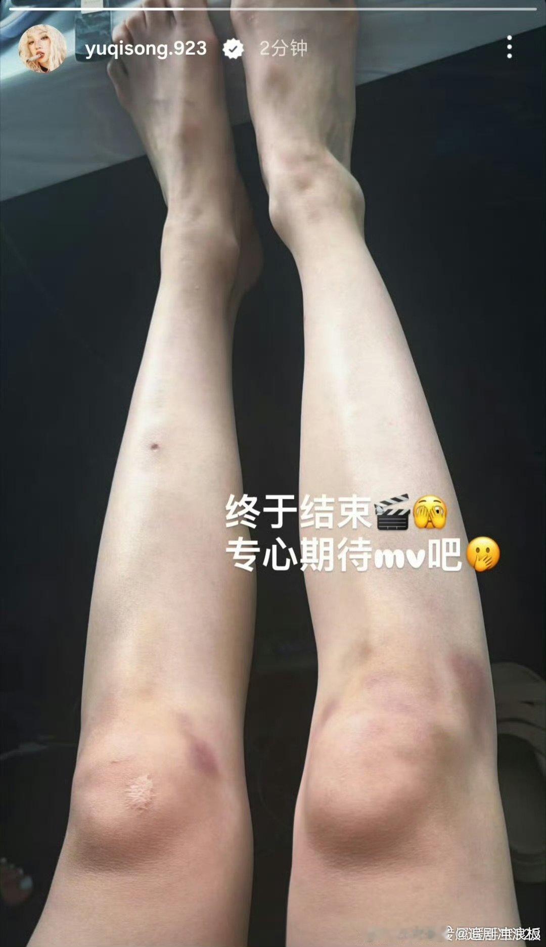 宋雨琦疑回应恋情宋雨琦专心期待mv吧 宋雨琦疑回应恋情，专心期待mv吧曝王嘉尔宋