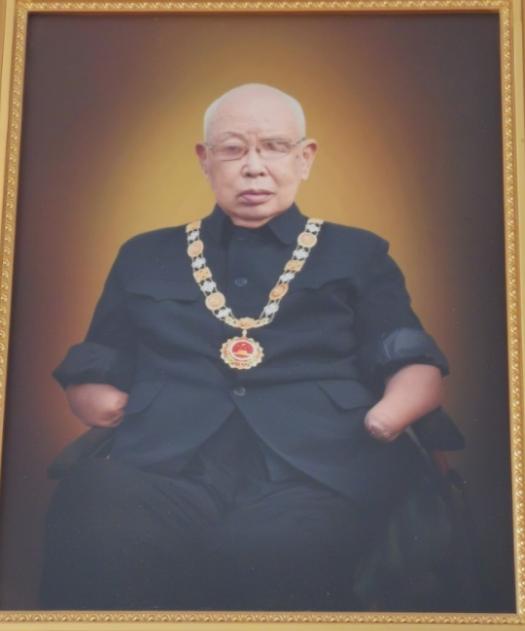 历经47次大小手术，整整昏迷93天，双手双脚全部截肢，左眼彻底失明，右眼仅剩0.