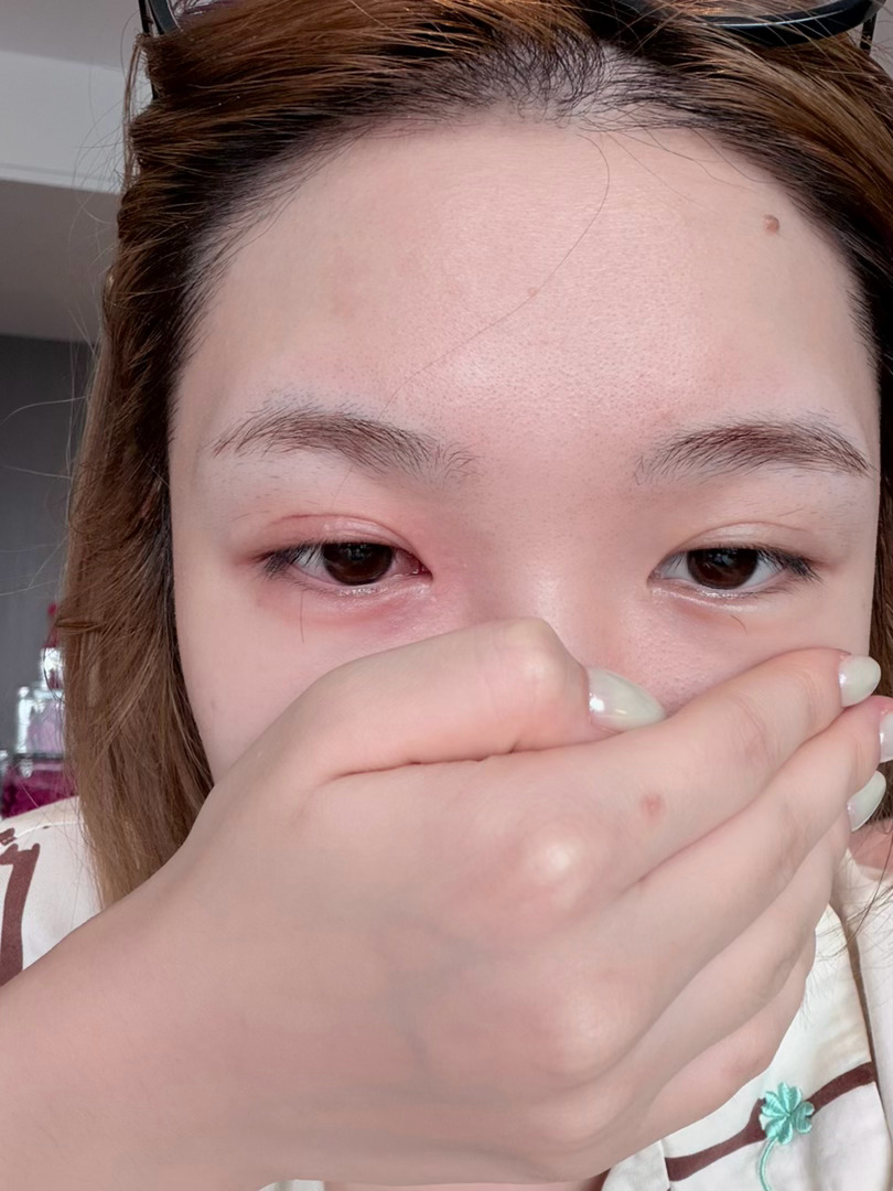 想问问大家有没有猫毛过敏的这种情况都是怎么样和小动物相处的？今天早上就吃饭的时候