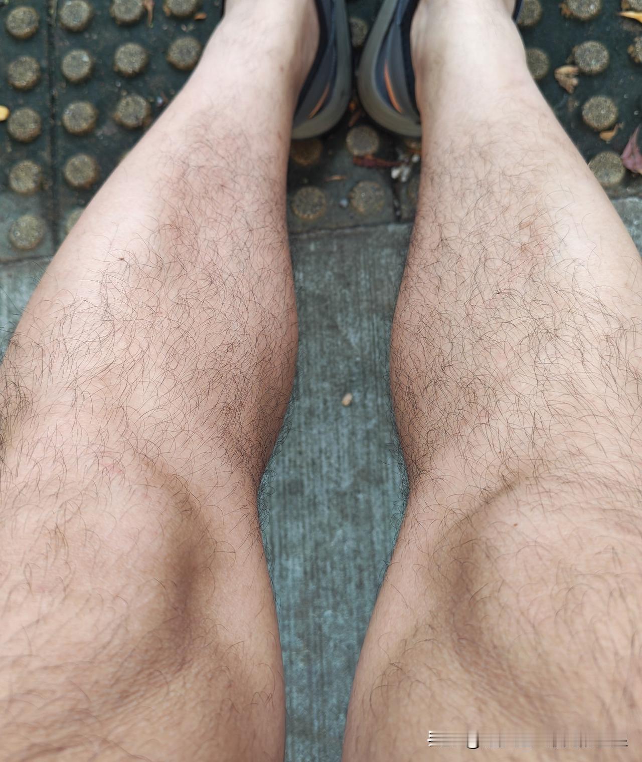 谁还没有腿毛呢？不信你看，这一腿毛就是天然防晒衣，可以防止紫外线伤害皮肤，也可以