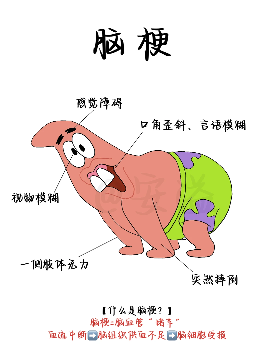 一分钟了解脑梗和急救知识科普