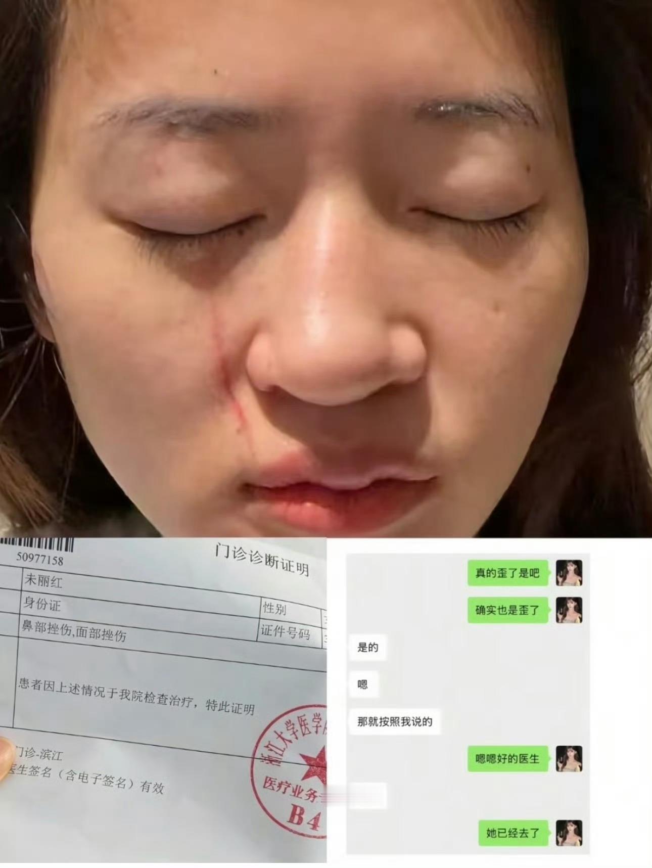 韩安冉赔偿助理10万元这不是一点惨啊这也太惨了 