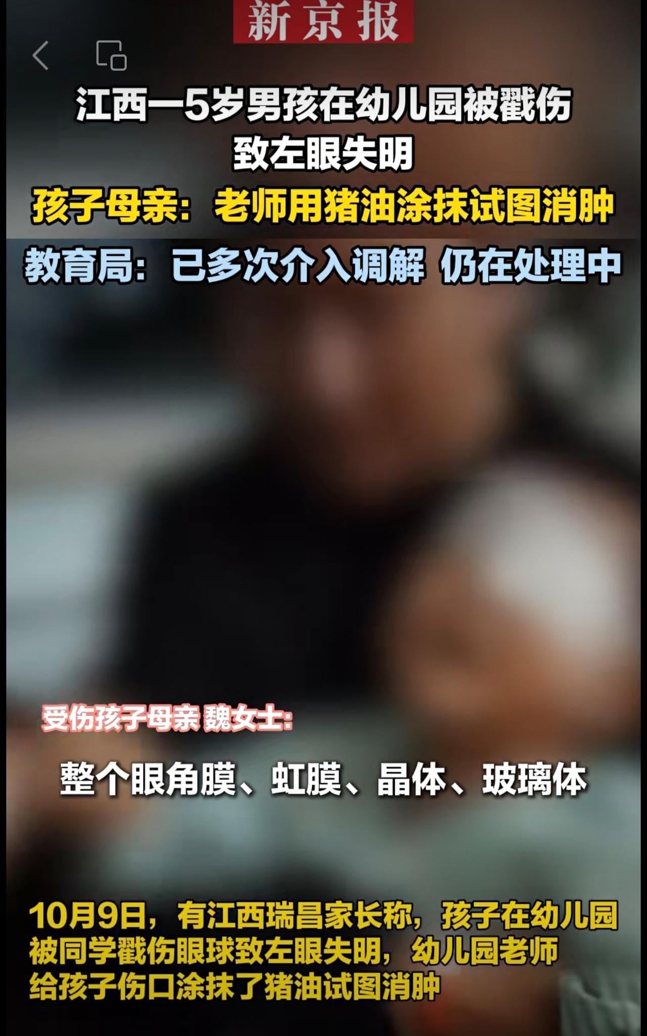 江西一5岁男孩在幼儿园被戳伤致左眼失明  孩子母亲：老师用猪油涂抹试图消肿  教