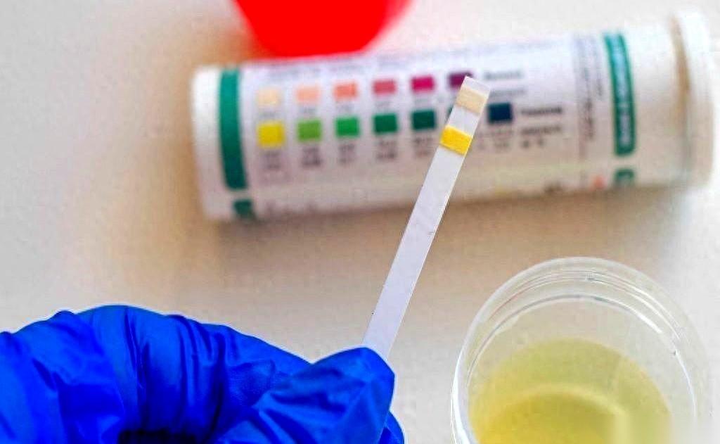 真正的大事，从不先敲锣打鼓。它往往是从你厕所里一个极其微小的变化开始的。
你方便