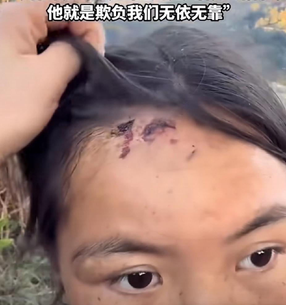 这种男人就不配有家！12月17日，四川一女生探望出嫁的姐姐，发现姐姐竟然满身伤痕