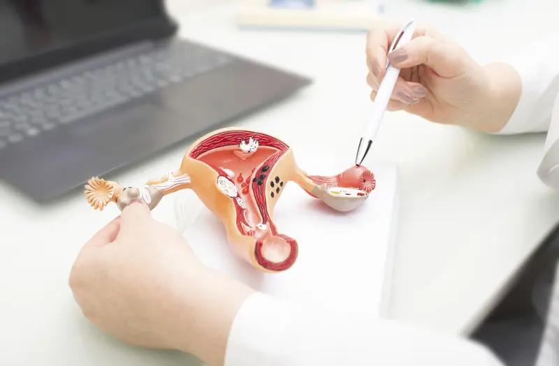 妻子切除输卵管几天后丈夫提离婚 这四川西充的事儿看得人来气！曹女士和张某闪婚后，