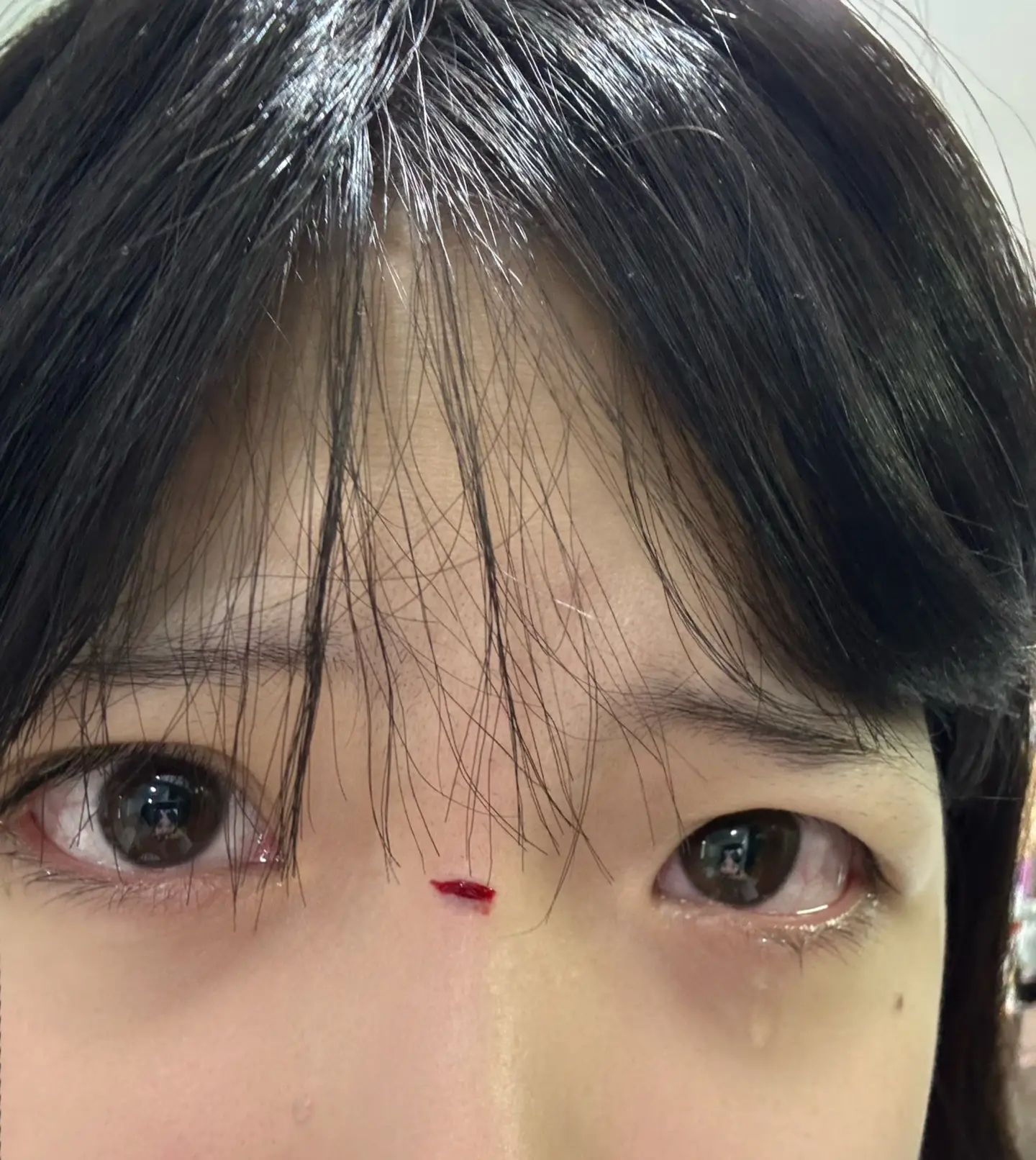漫展前一天收拾行李被桌子砸到鼻梁，好崩溃… 哭了半小时…会不会留疤…都...