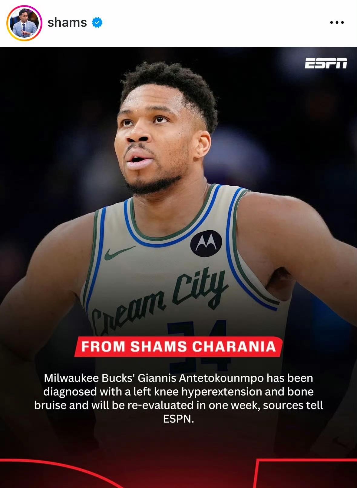 字母哥彻底废了！他被诊断为左膝过度伸展和骨挫伤，将于一周后重新评估。
本赛季累计