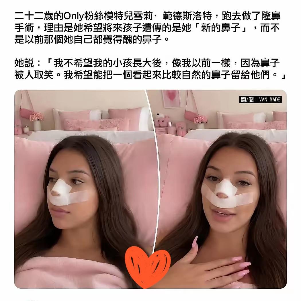 没文化真可怕
这22岁模特雪莉的操作
直接看懵众人！隆鼻想让孩子遗传新鼻子，这想