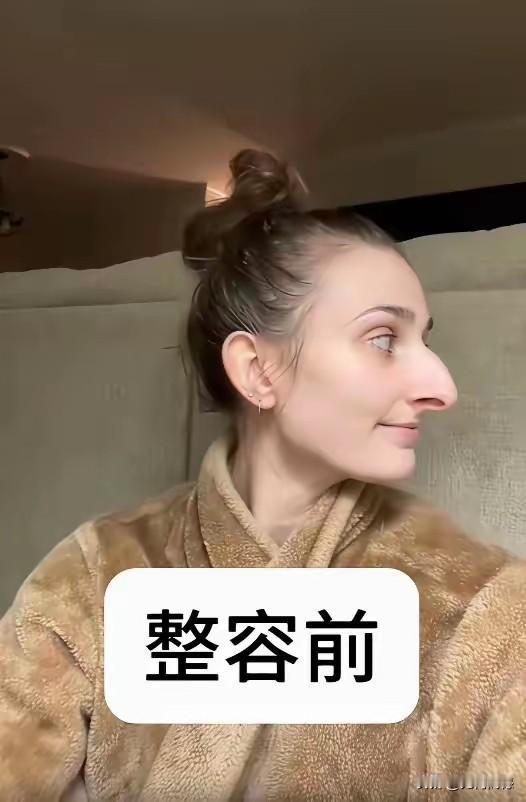 鼻子大，很漂亮，为什么还要美容呢？也不知道这些人是怎么想的，一个人的相貌是祖辈的