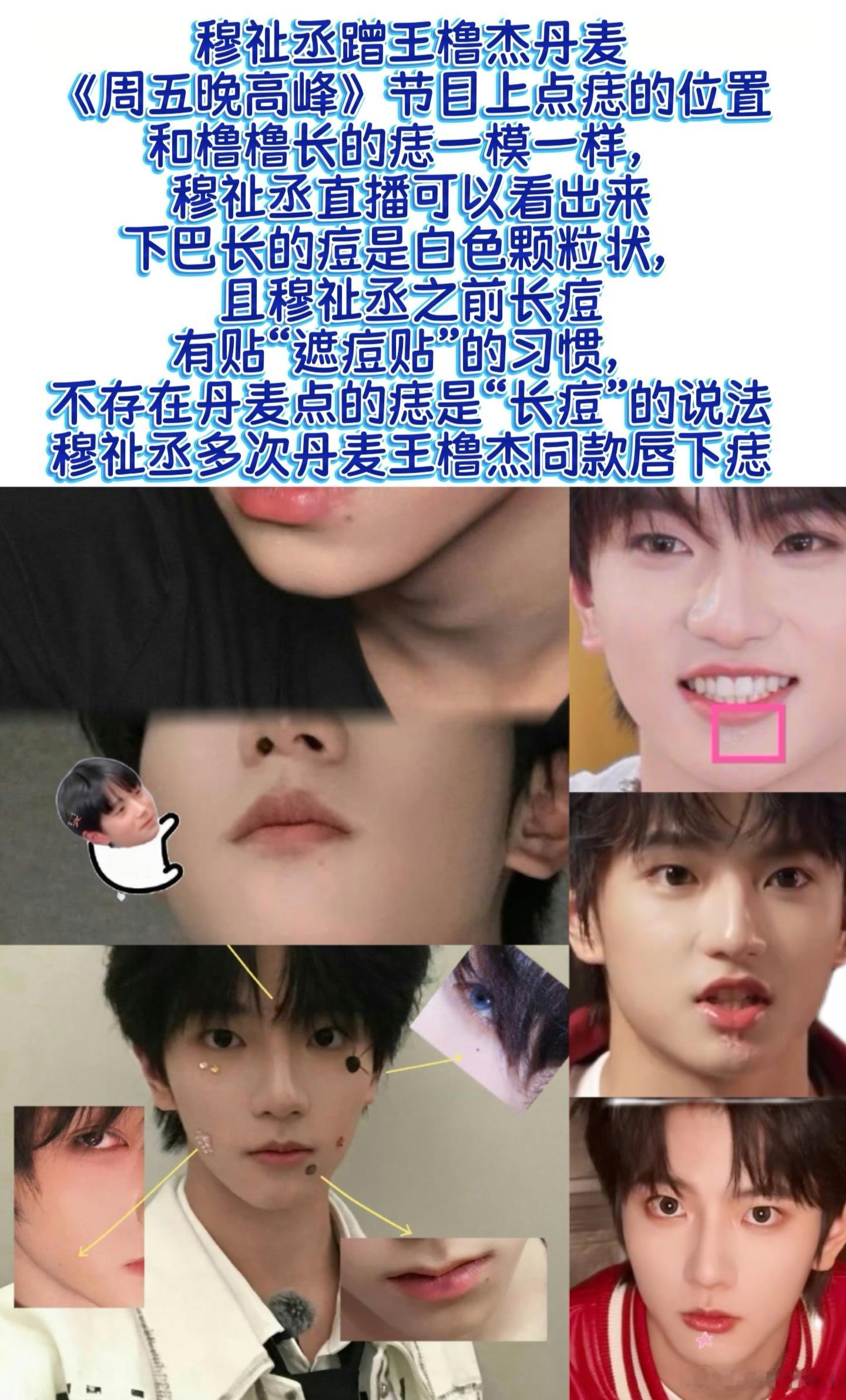墩子为了丹麦，长出了唇下痣！你以为这只是丹麦吗？其实这只是祉瑛玩剩下的🍬了。墩