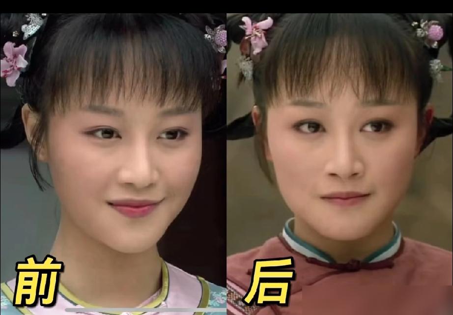 你胖了20斤，还想不想干了？ 郑晓龙当着全剧组，指着蓝盈莹的鼻子骂。这事，你真看